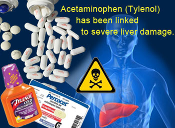 acetaminophen Tylenol caused liver failure death